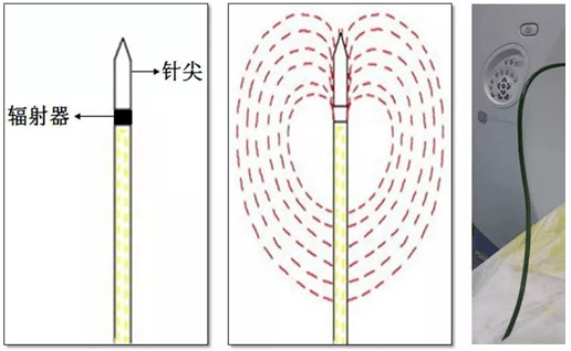 消融是什么意思(穿刺消融是什么意思)